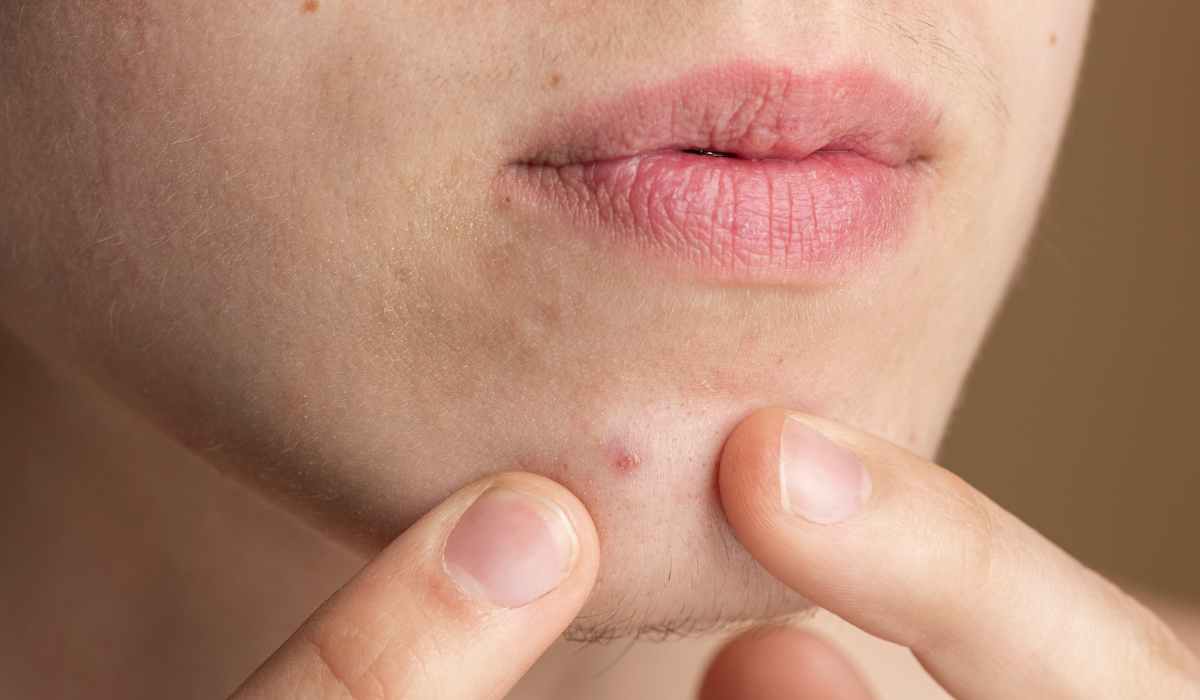 Granos internos, causas y soluciones